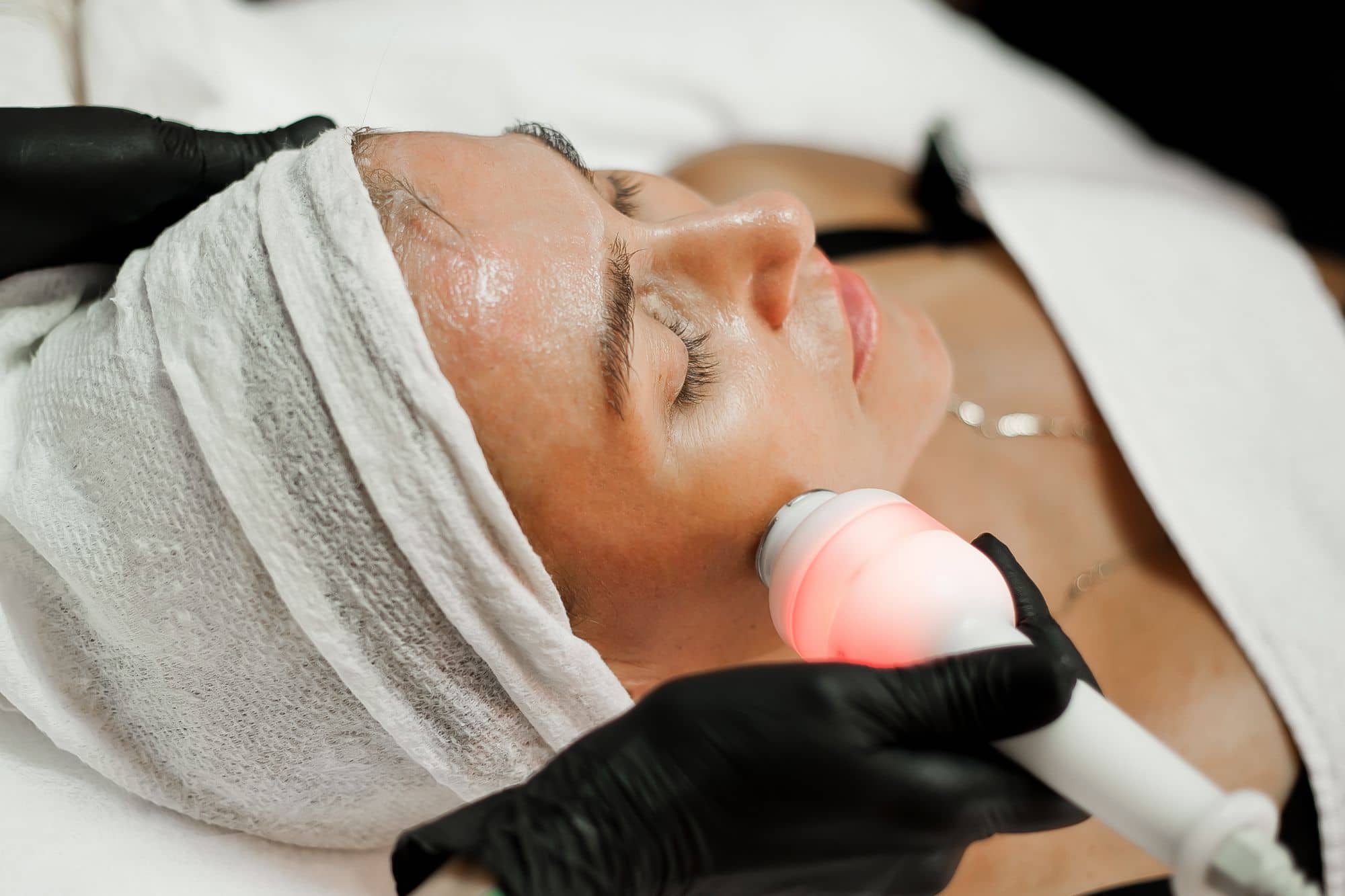 RF-lifting of face, neck and décolleté using Overline equipment at Esteticare